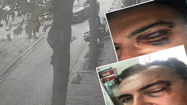 Sokakta kedi besleyen iş insanına güpegündüz saldırı