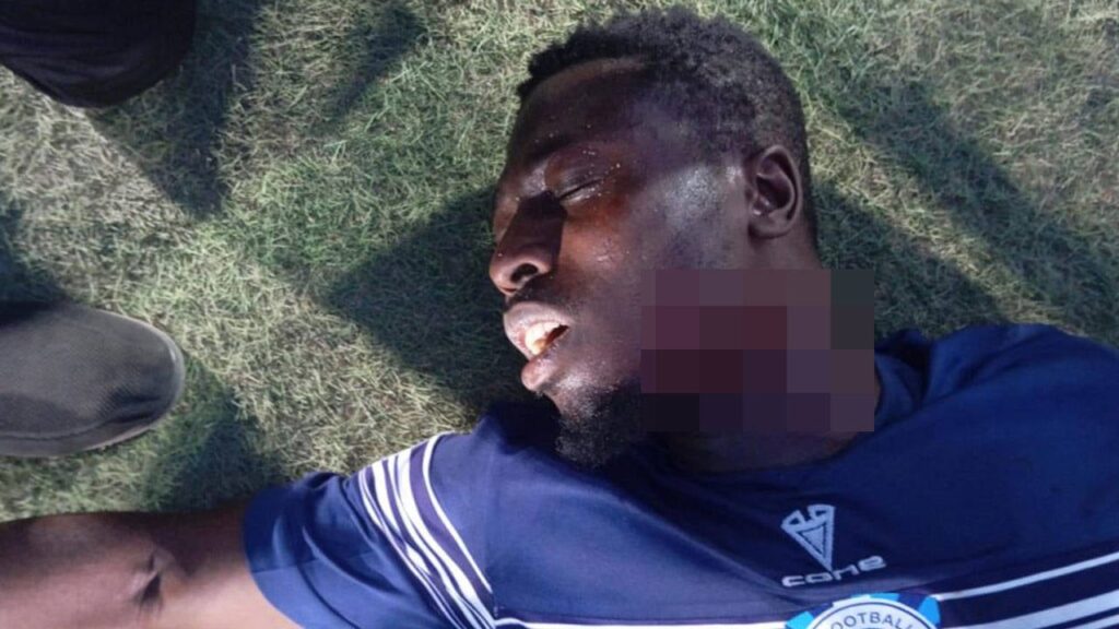 Nijerya’da dehşet: Taraftarlar futbolcuyu boğazından yaraladı