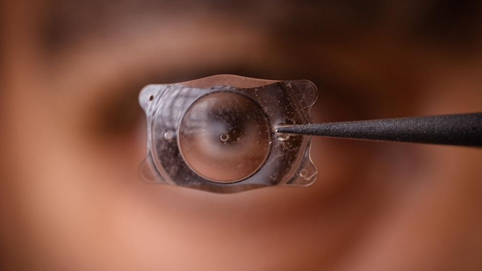 Чип за очна протеза дава надежда за загуба на зрението в Европа