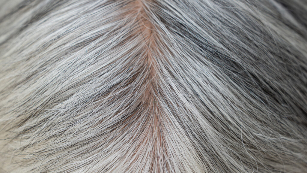 Мистерията на посивяването на косата: Защита от рак или стареене?